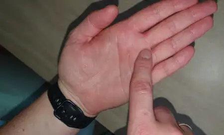 Hand feels like oversized dog
